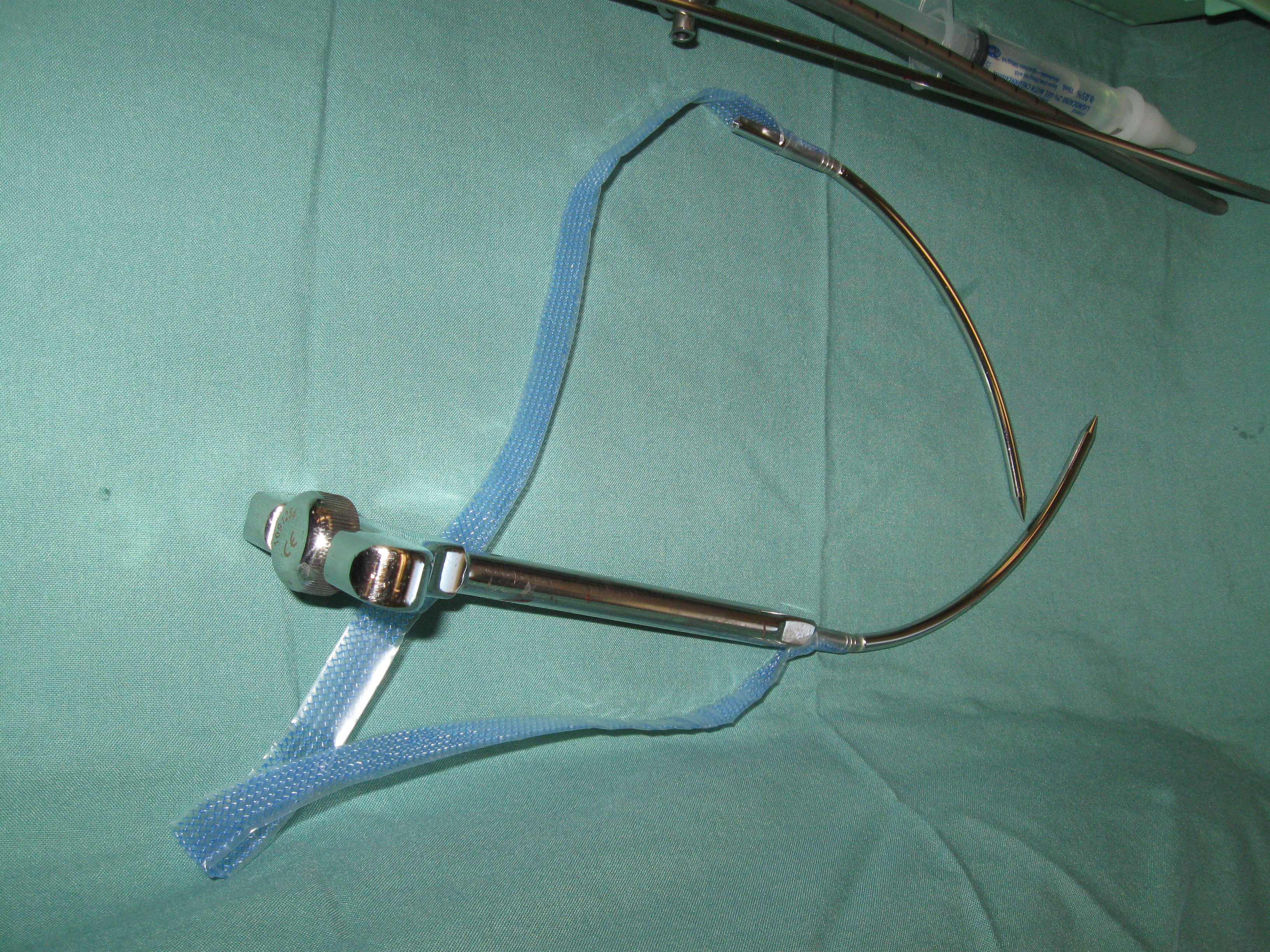 Tension Free Vaginal Tape Needles and Introducer Serag Youssif Tension Free Vaginal Tape Needles and Introducer Serag Youssif